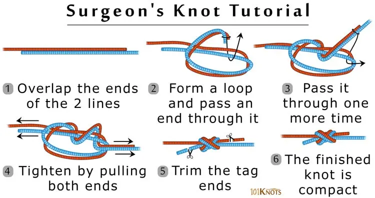 How to Tie a Surgeon's Knot
